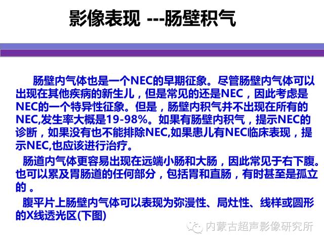 影像PPT - 【PPT】坏死性小肠结肠炎-14