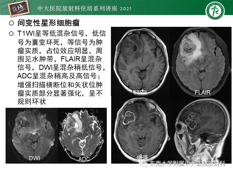 影像PPT - 【PPT】颅内环形强化病变的影像鉴别诊断-8