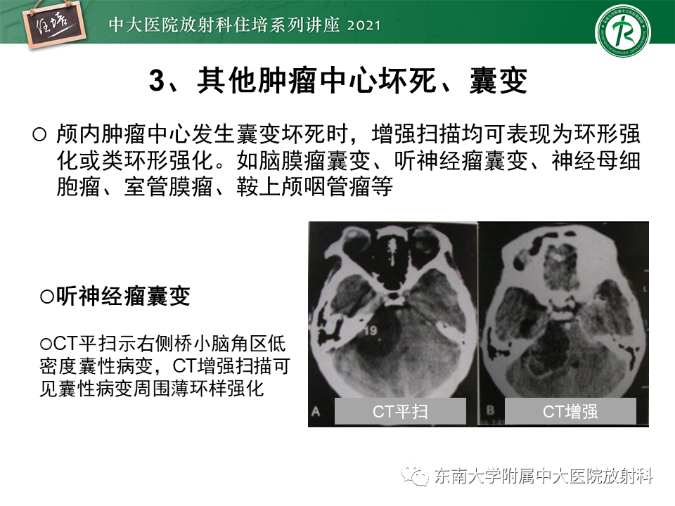 影像PPT - 【PPT】颅内环形强化病变的影像鉴别诊断-12