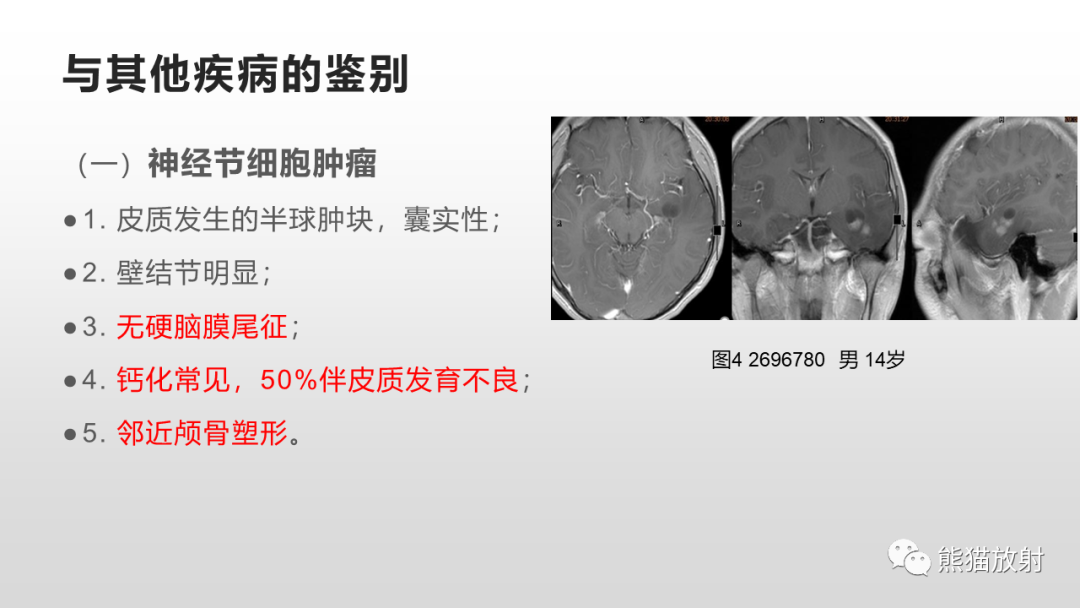 影像PPT - 【病例】多形性黄色星形细胞瘤2例MR影像-30