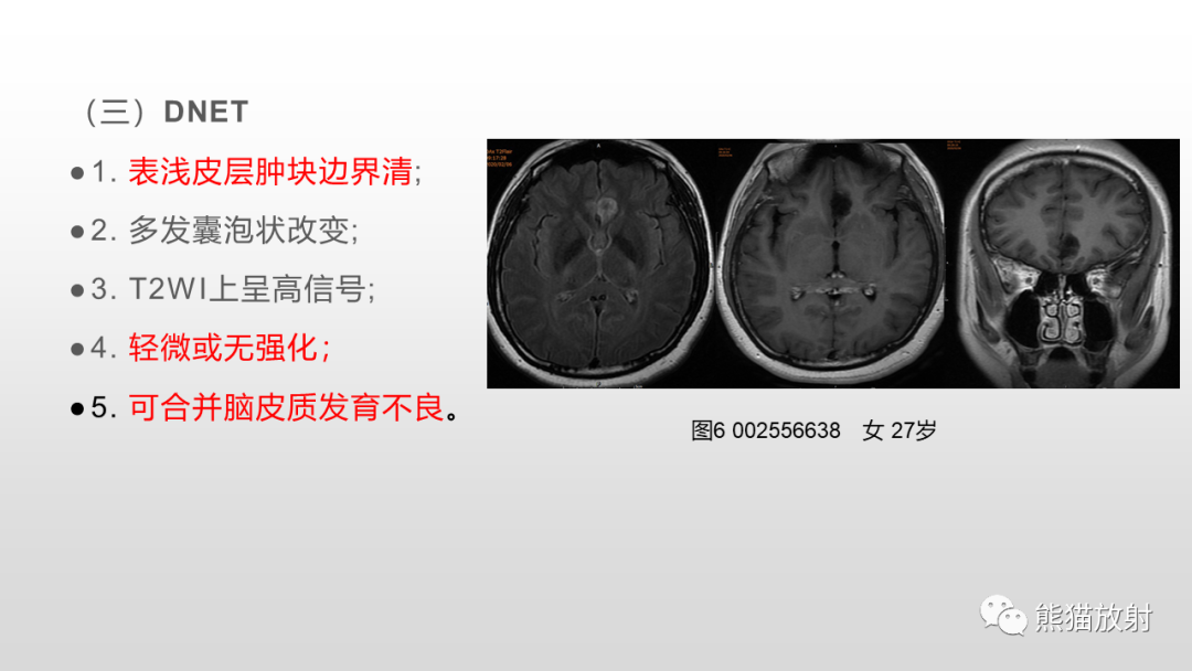 影像PPT - 【病例】多形性黄色星形细胞瘤2例MR影像-32