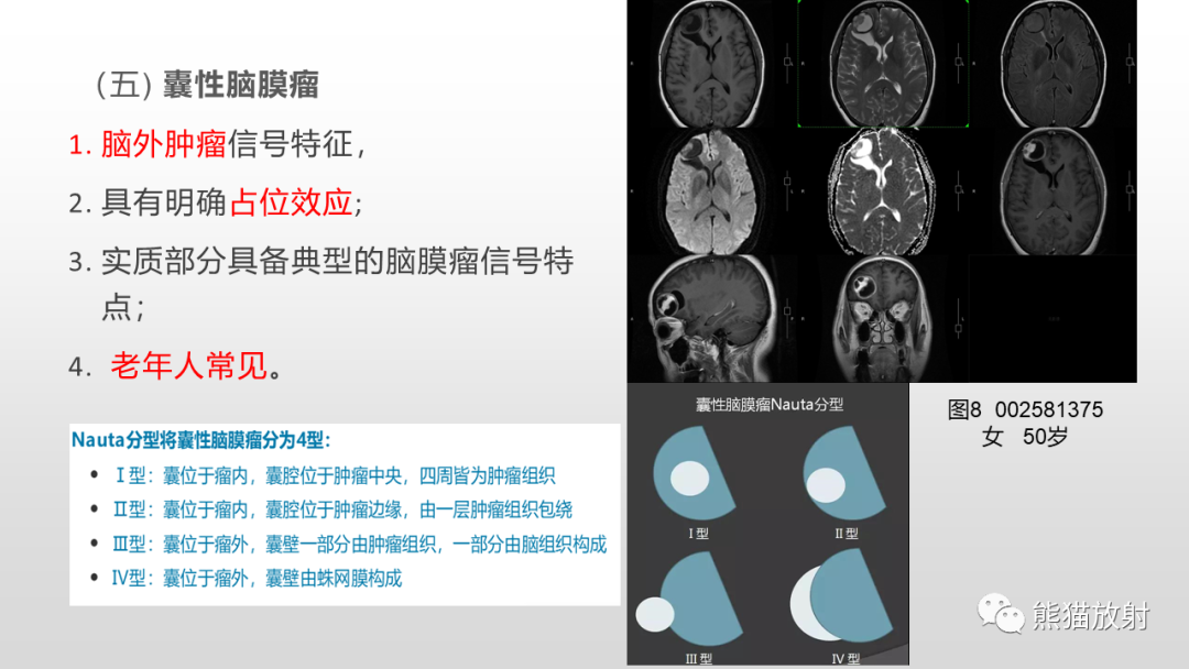 影像PPT - 【病例】多形性黄色星形细胞瘤2例MR影像-34