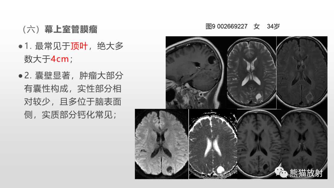 影像PPT - 【病例】多形性黄色星形细胞瘤2例MR影像-35