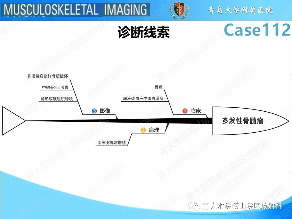 影像PPT - 【PPT】多发性骨髓瘤：颅骨-20