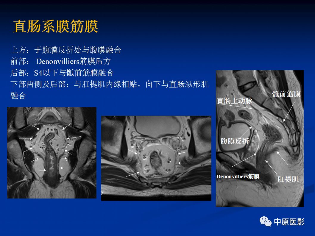 影像PPT - 【PPT】直肠癌的MRI诊断-9