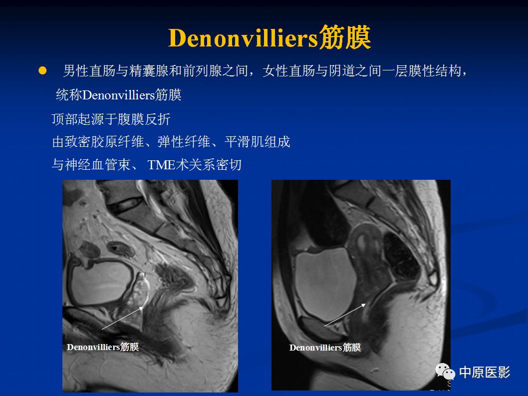 影像PPT - 【PPT】直肠癌的MRI诊断-13