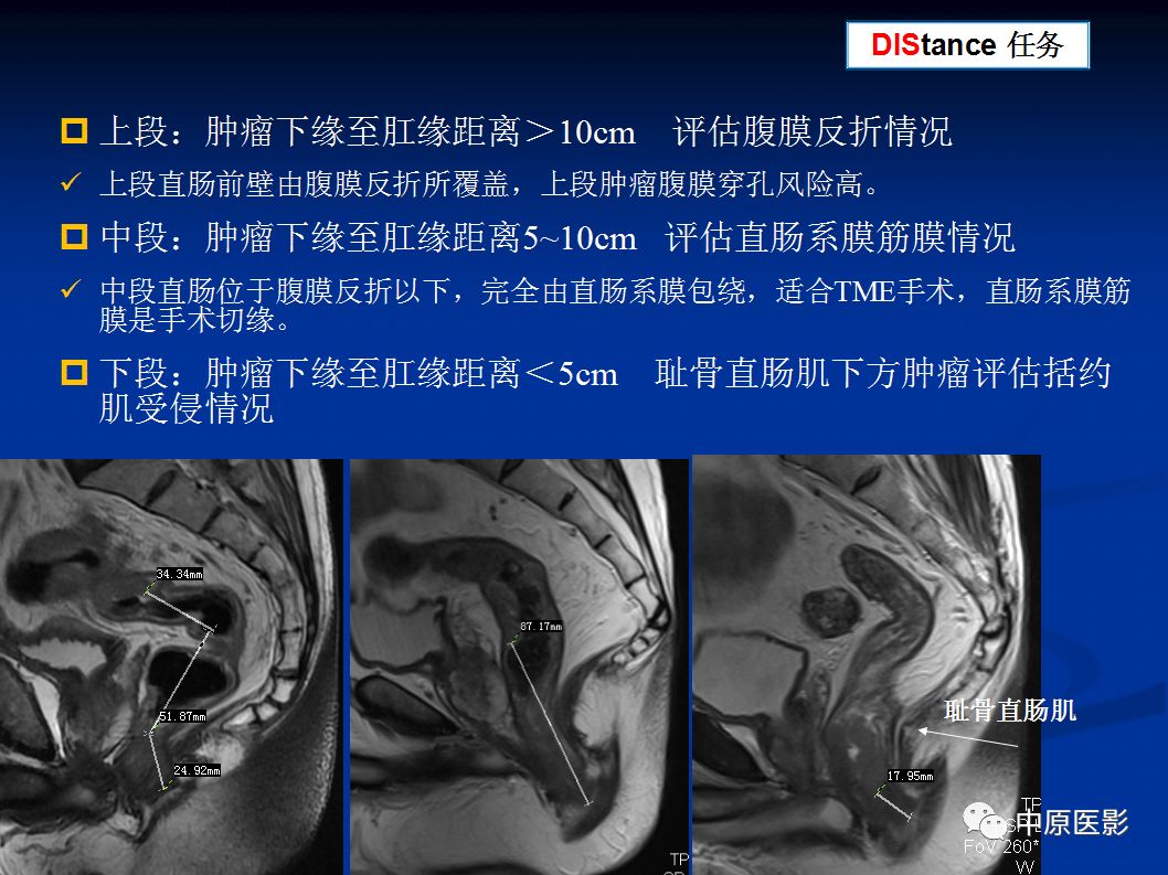 影像PPT - 【PPT】直肠癌的MRI诊断-16