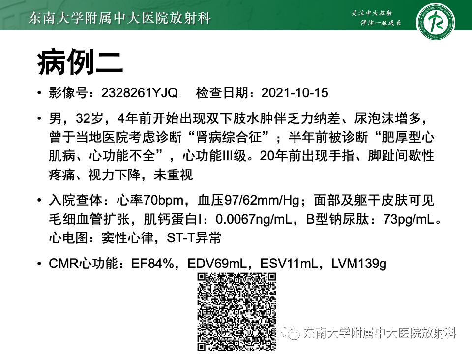 影像PPT - 【病例】法布雷病4例MR-20 影像PPT - 【病例】法布雷病4例MR-20