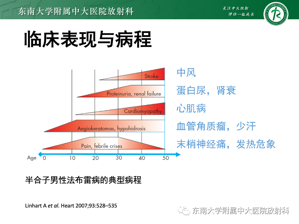 影像PPT - 【病例】法布雷病4例MR-40 影像PPT - 【病例】法布雷病4例MR-40
