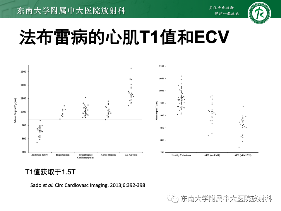 影像PPT - 【病例】法布雷病4例MR-44 影像PPT - 【病例】法布雷病4例MR-44