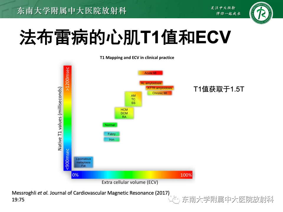 影像PPT - 【病例】法布雷病4例MR-45 影像PPT - 【病例】法布雷病4例MR-45