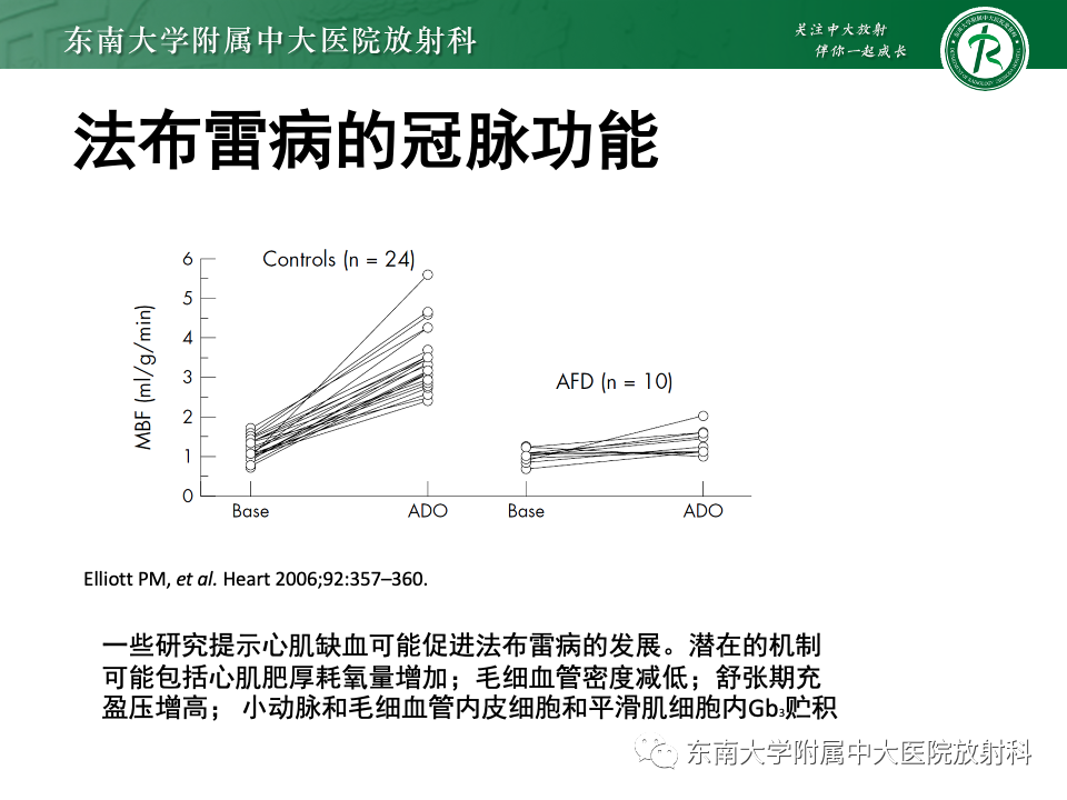 影像PPT - 【病例】法布雷病4例MR-49 影像PPT - 【病例】法布雷病4例MR-49
