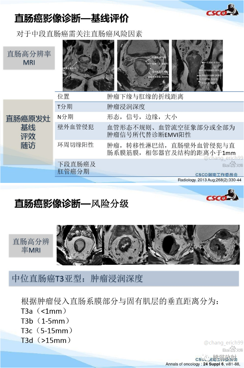 影像PPT - 直肠癌MRI解剖、扫描规范、影像学评价、结构式报告-5