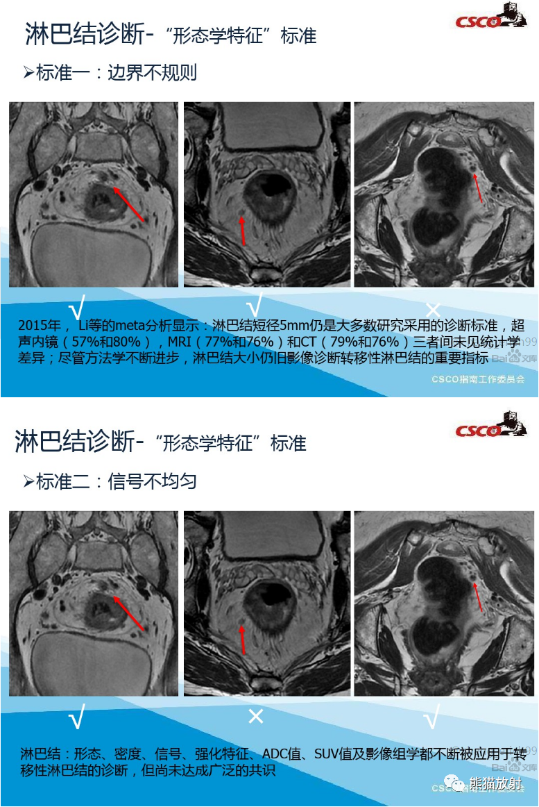 影像PPT - 直肠癌MRI解剖、扫描规范、影像学评价、结构式报告-8