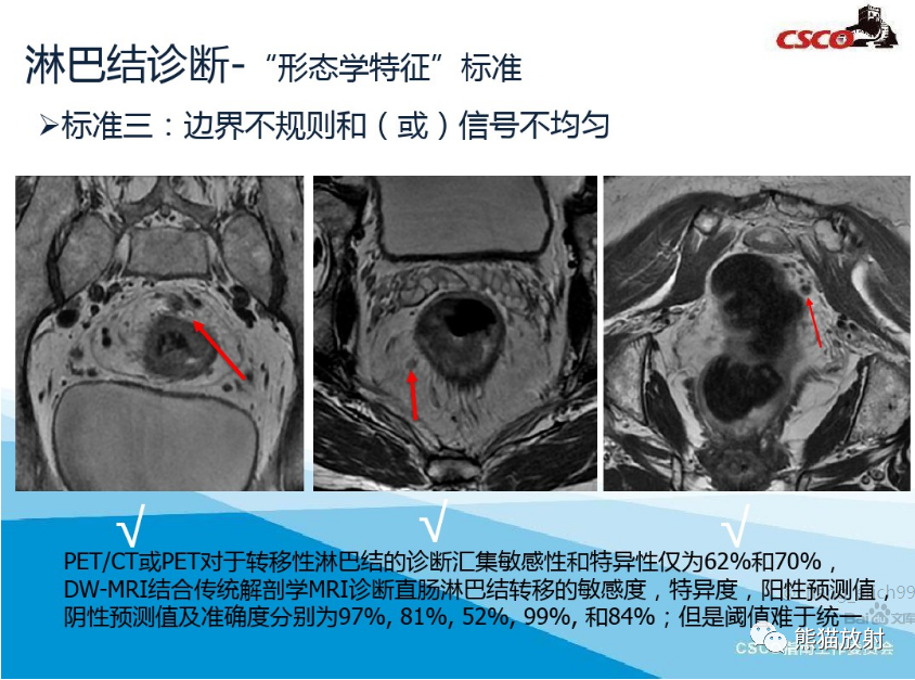 影像PPT - 直肠癌MRI解剖、扫描规范、影像学评价、结构式报告-9