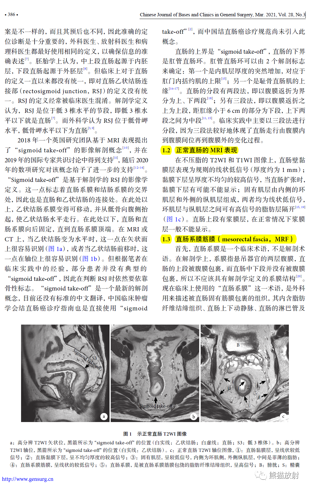 影像PPT - 直肠癌MRI解剖、扫描规范、影像学评价、结构式报告-29