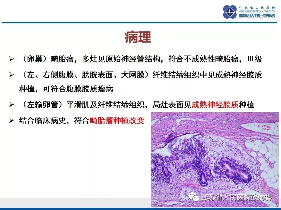 影像PPT - 【PPT】不成熟性畸胎瘤-16