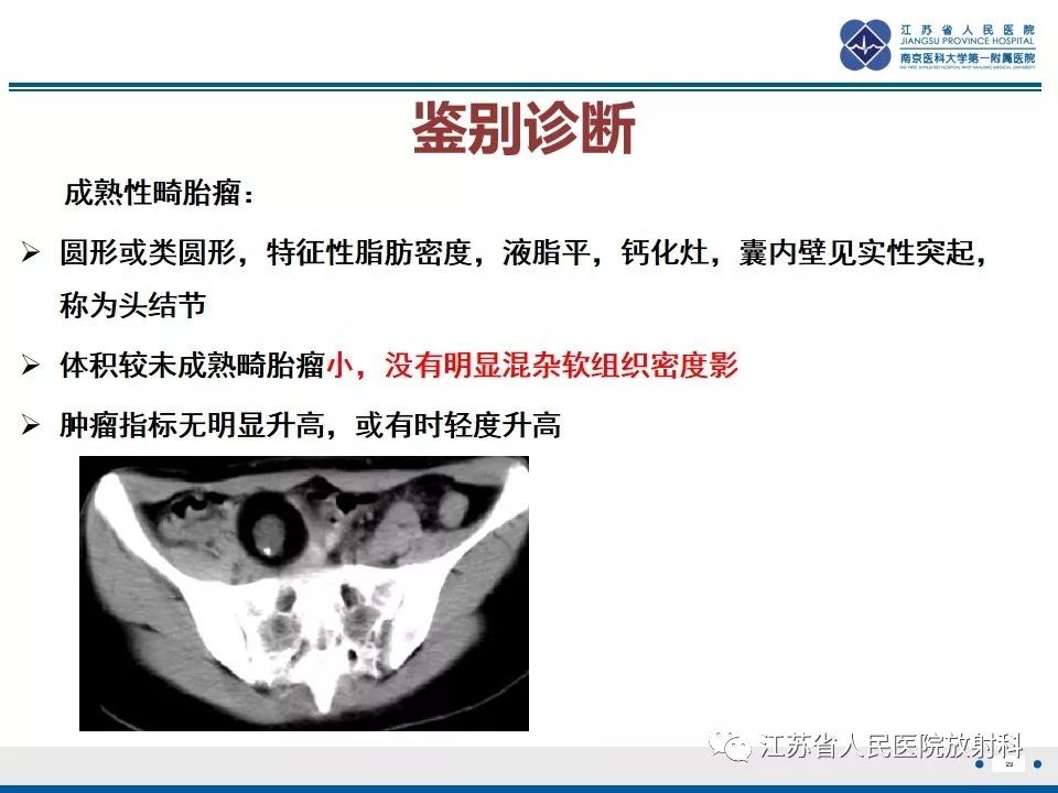 影像PPT - 【PPT】不成熟性畸胎瘤-29