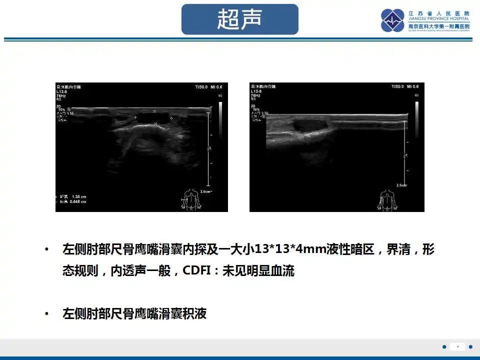 影像PPT - 【PPT】结节性筋膜炎-8