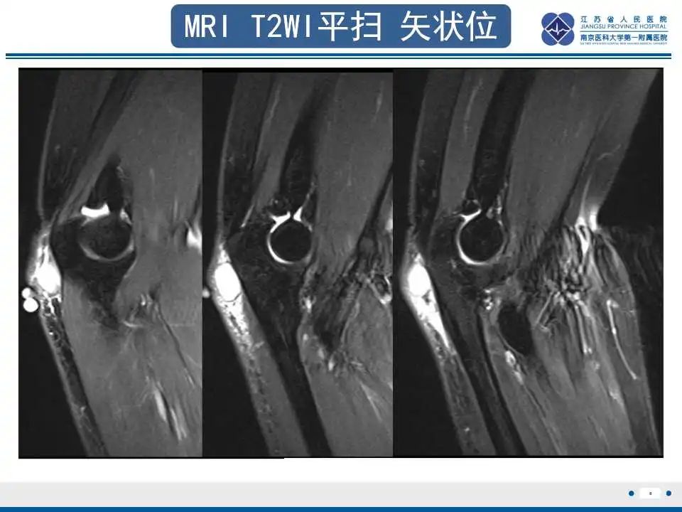 影像PPT - 【PPT】结节性筋膜炎-7