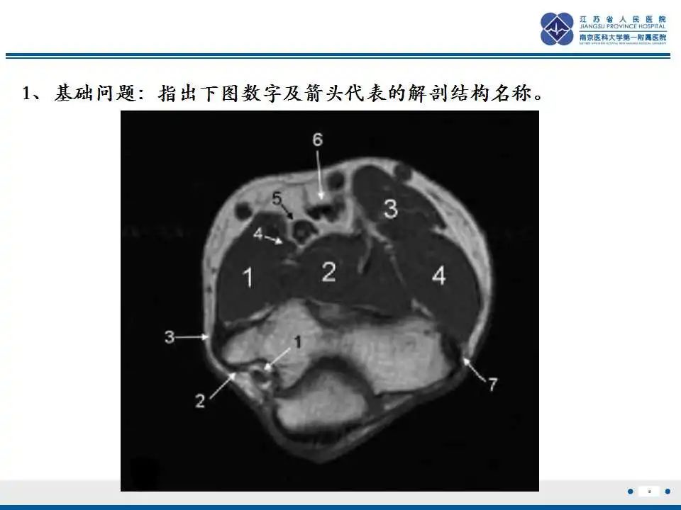 影像PPT - 【PPT】结节性筋膜炎-9