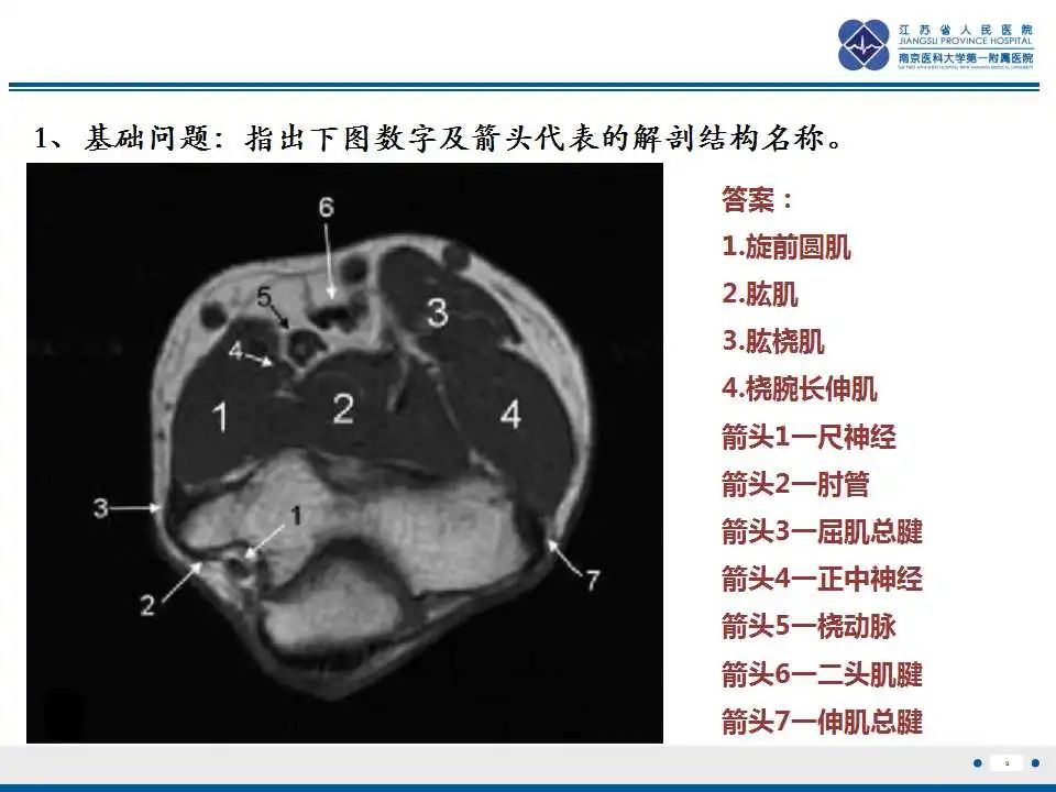 影像PPT - 【PPT】结节性筋膜炎-10