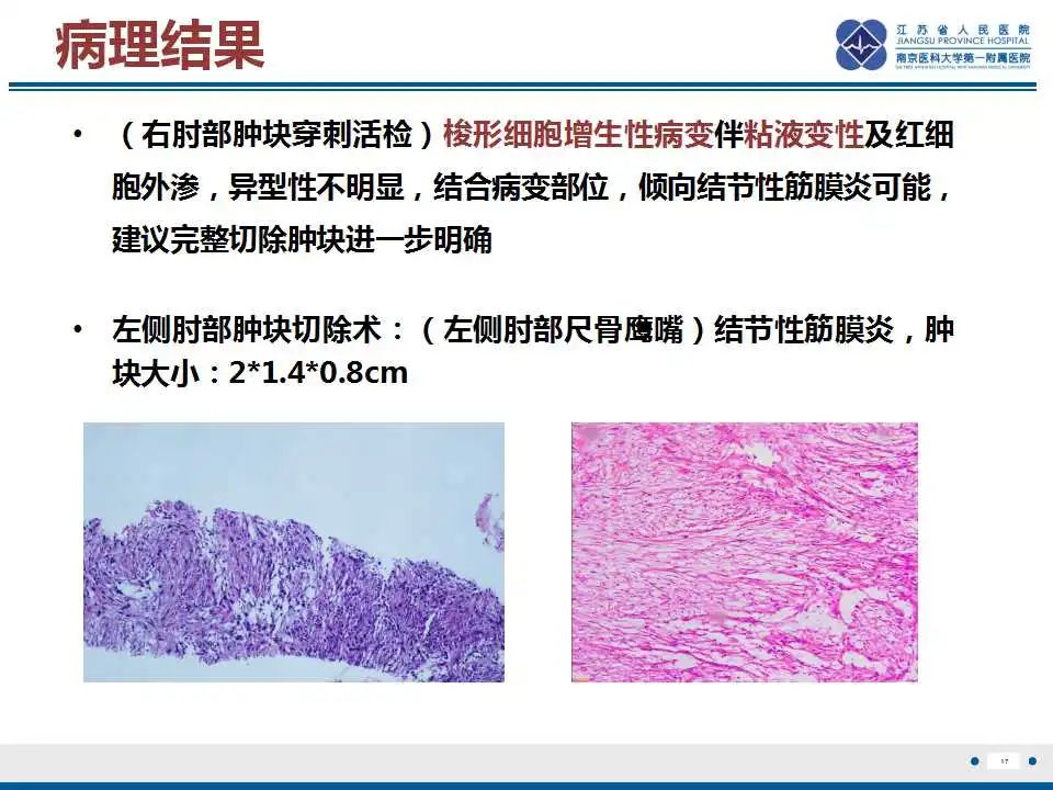 影像PPT - 【PPT】结节性筋膜炎-18