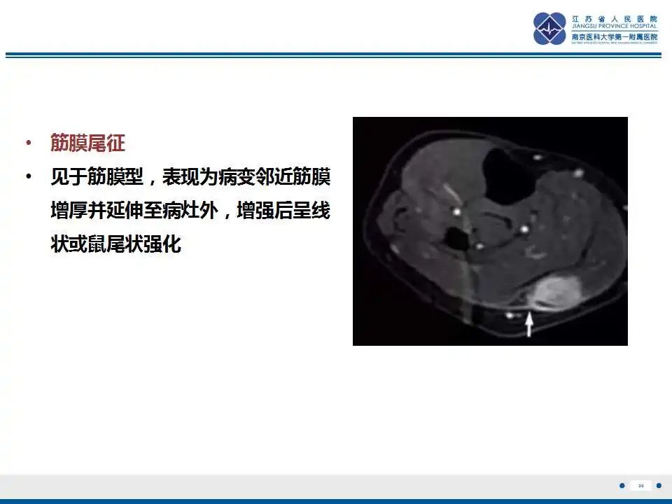 影像PPT - 【PPT】结节性筋膜炎-31