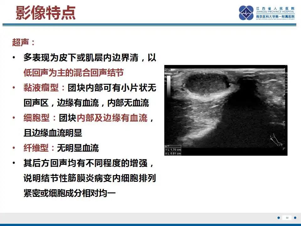 影像PPT - 【PPT】结节性筋膜炎-33
