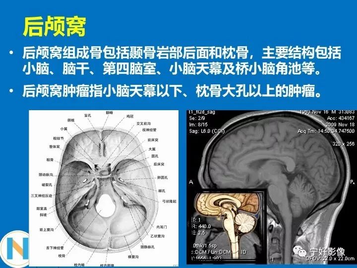 影像PPT - 【PPT】后颅窝常见肿瘤影像诊断与鉴别诊断-2