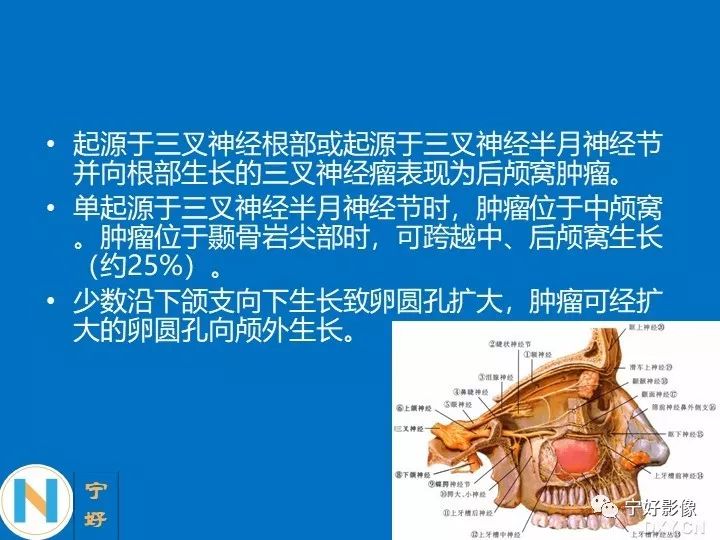 影像PPT - 【PPT】后颅窝常见肿瘤影像诊断与鉴别诊断-16