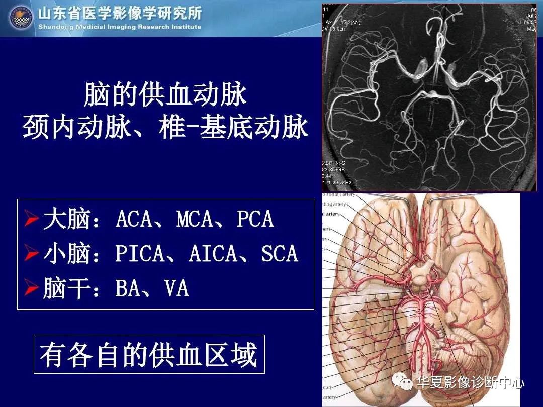 影像PPT - 【PPT】缺血性脑血管病的影像诊断-3