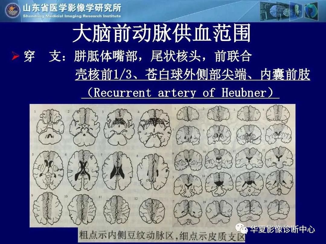 影像PPT - 【PPT】缺血性脑血管病的影像诊断-5
