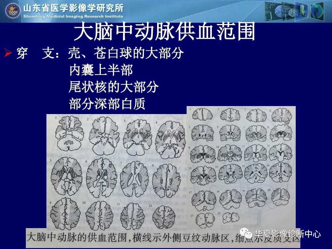影像PPT - 【PPT】缺血性脑血管病的影像诊断-8