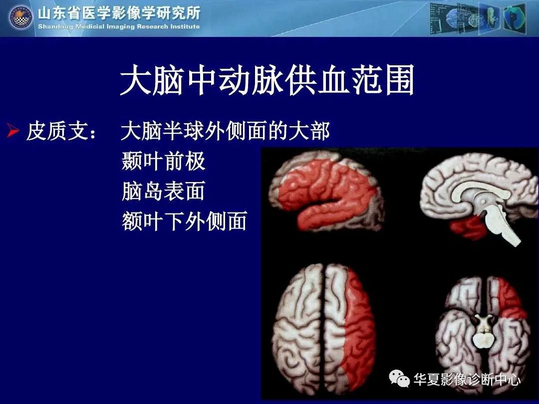 影像PPT - 【PPT】缺血性脑血管病的影像诊断-7
