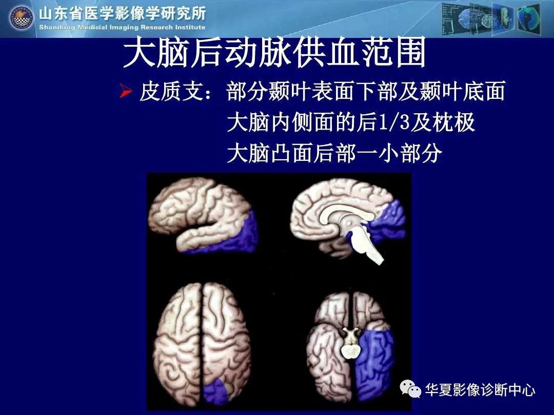 影像PPT - 【PPT】缺血性脑血管病的影像诊断-12