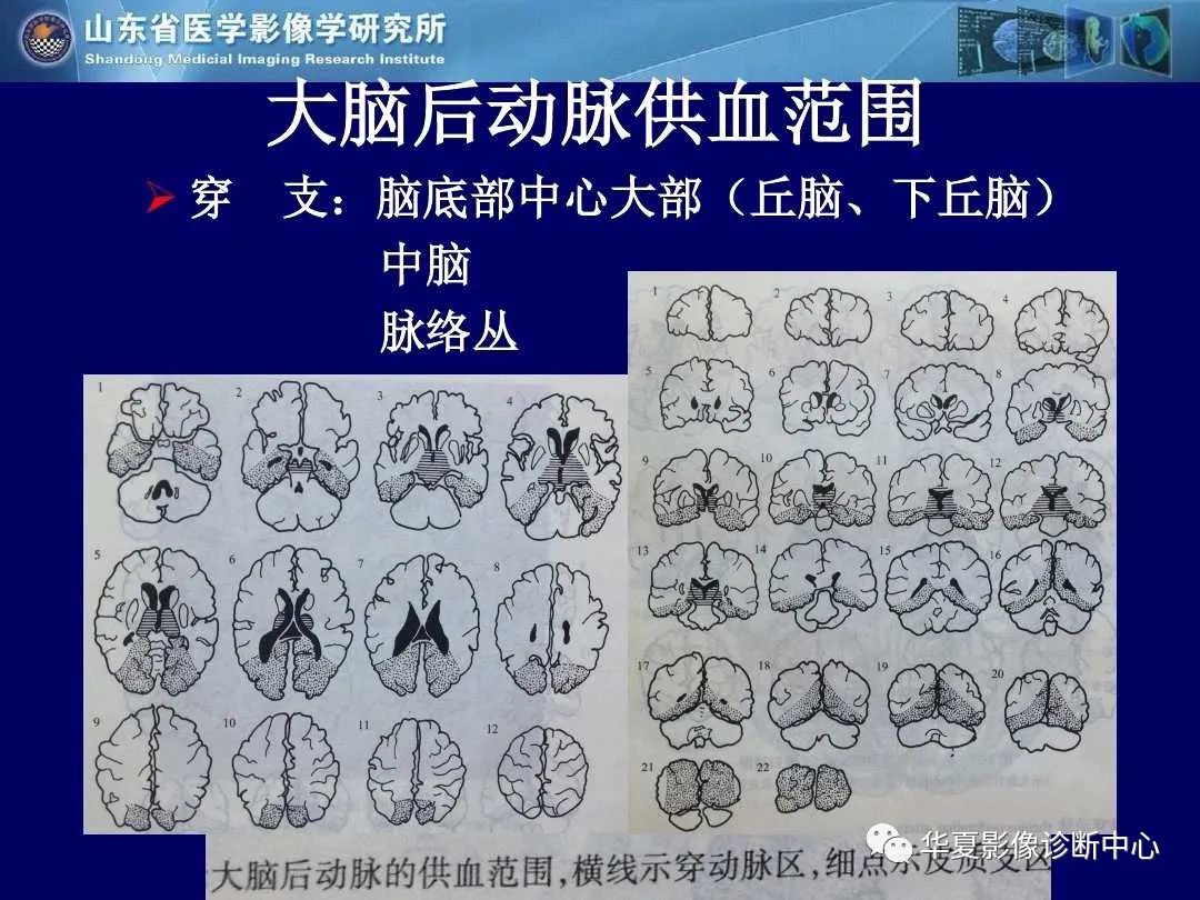影像PPT - 【PPT】缺血性脑血管病的影像诊断-13