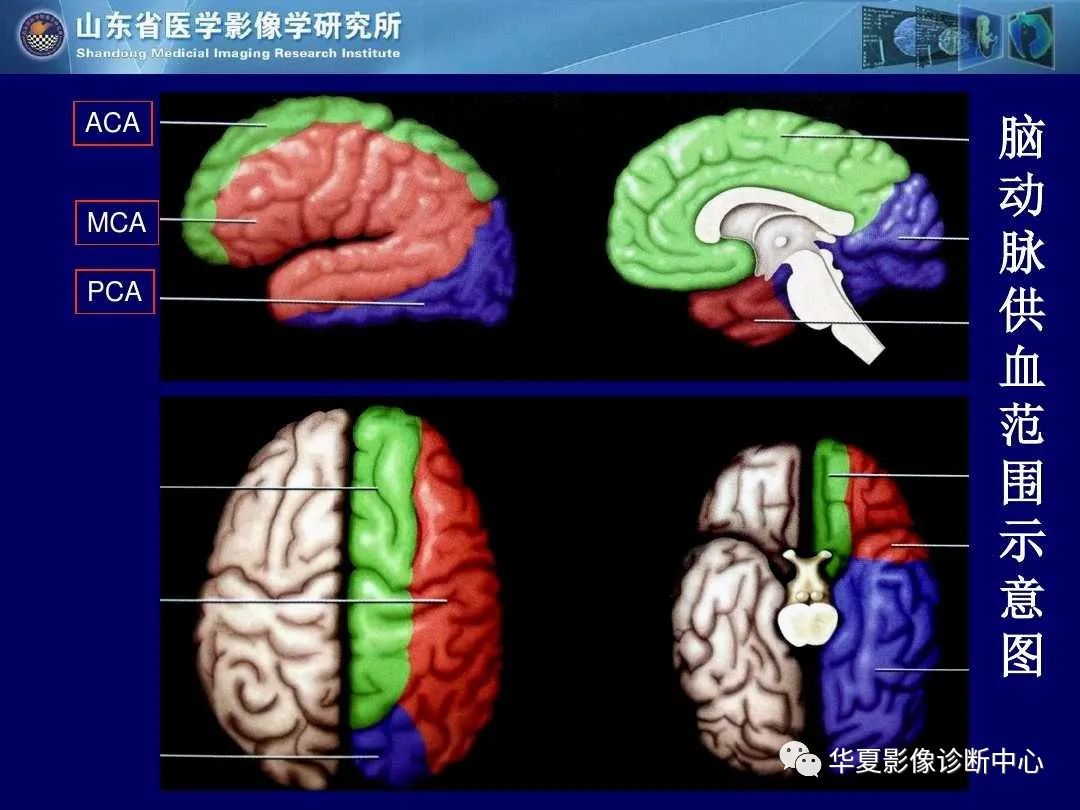 影像PPT - 【PPT】缺血性脑血管病的影像诊断-15