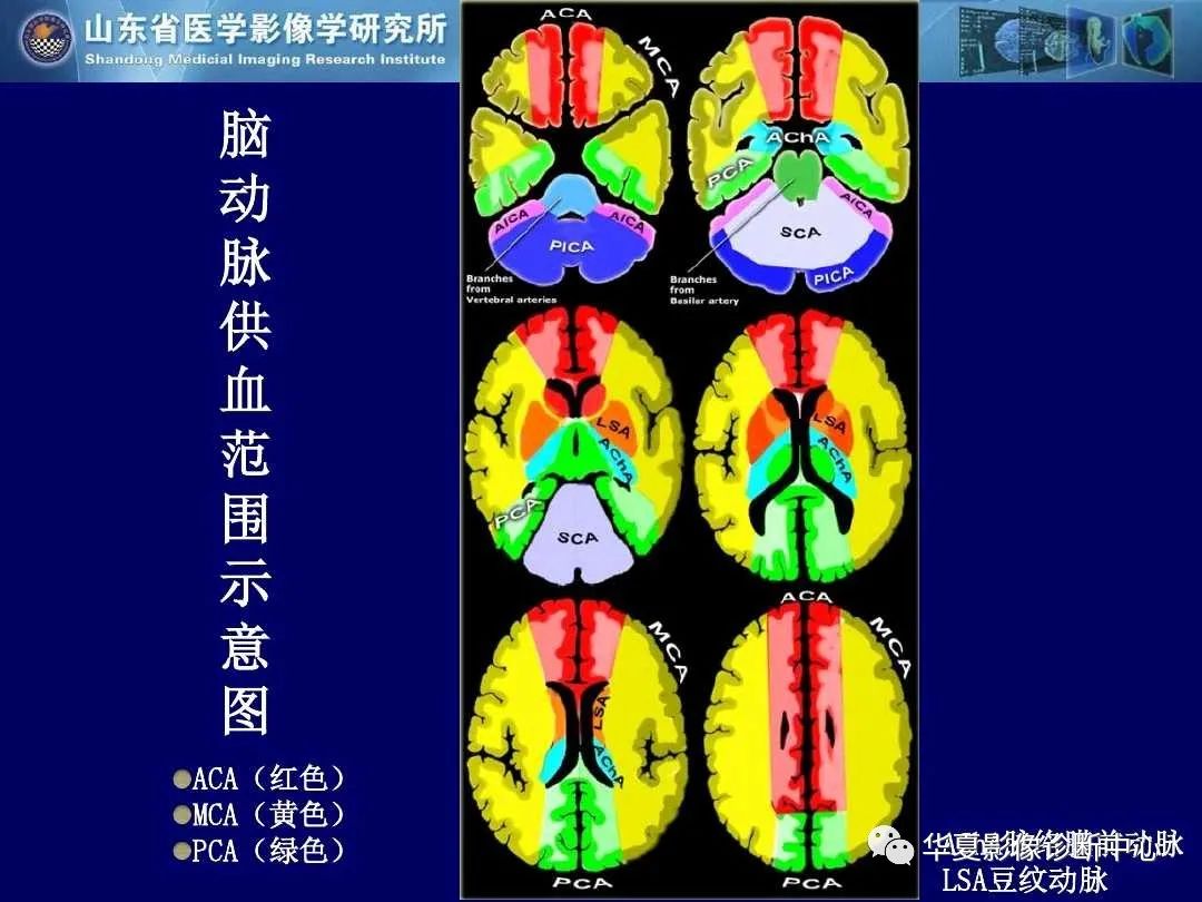 影像PPT - 【PPT】缺血性脑血管病的影像诊断-16