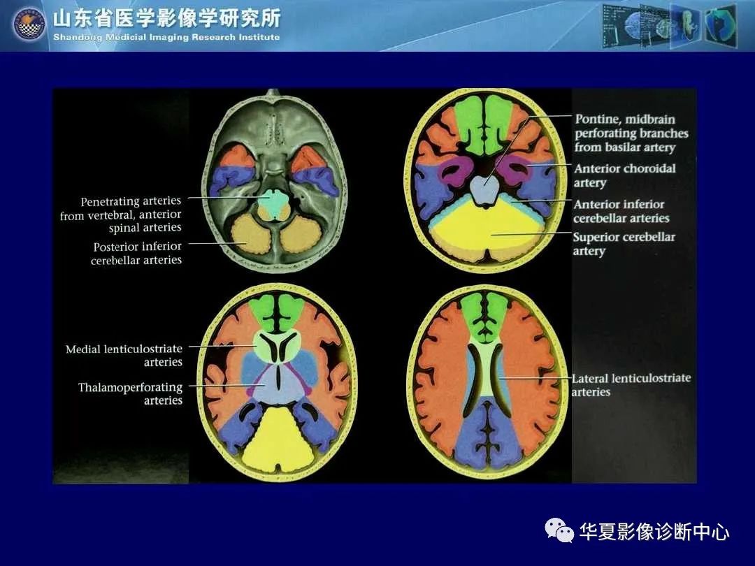 影像PPT - 【PPT】缺血性脑血管病的影像诊断-17