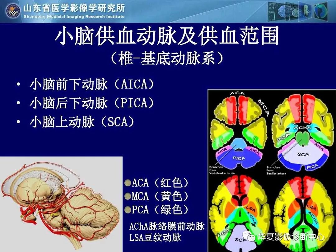 影像PPT - 【PPT】缺血性脑血管病的影像诊断-24
