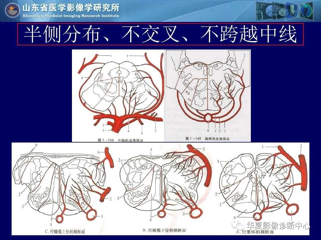 影像PPT - 【PPT】缺血性脑血管病的影像诊断-28