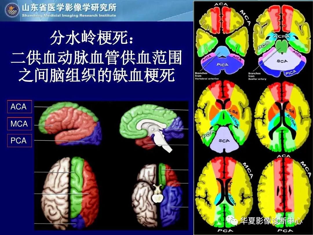 影像PPT - 【PPT】缺血性脑血管病的影像诊断-38