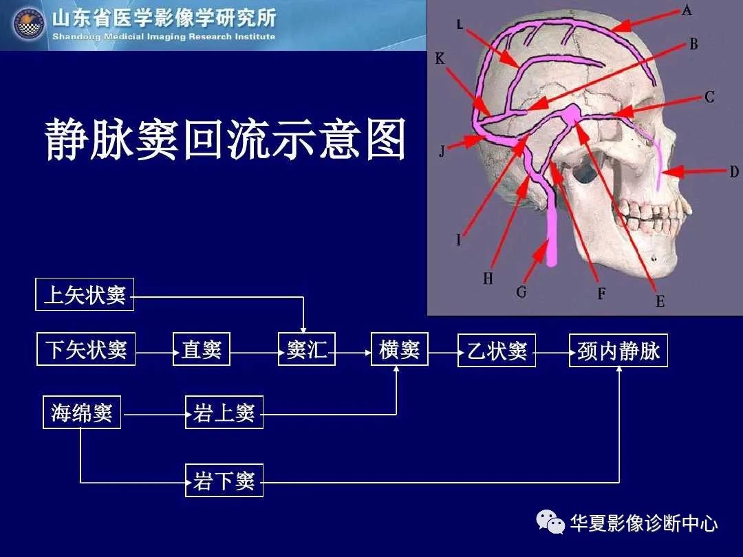 影像PPT - 【PPT】缺血性脑血管病的影像诊断-67