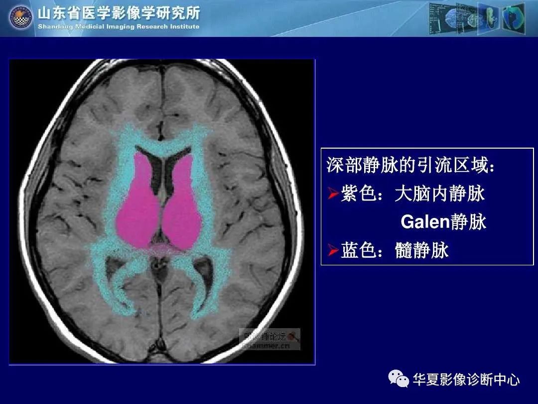 影像PPT - 【PPT】缺血性脑血管病的影像诊断-71