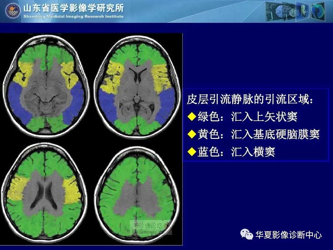 影像PPT - 【PPT】缺血性脑血管病的影像诊断-69