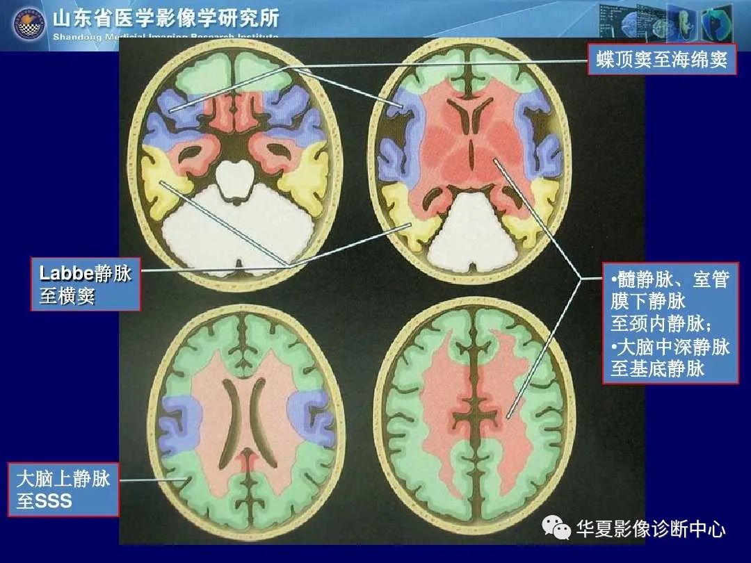 影像PPT - 【PPT】缺血性脑血管病的影像诊断-72