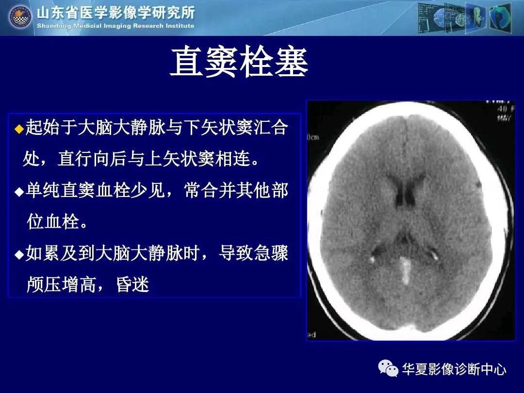 影像PPT - 【PPT】缺血性脑血管病的影像诊断-91
