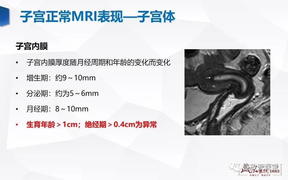 影像PPT - 【PPT】子宫病变MRI诊断-5