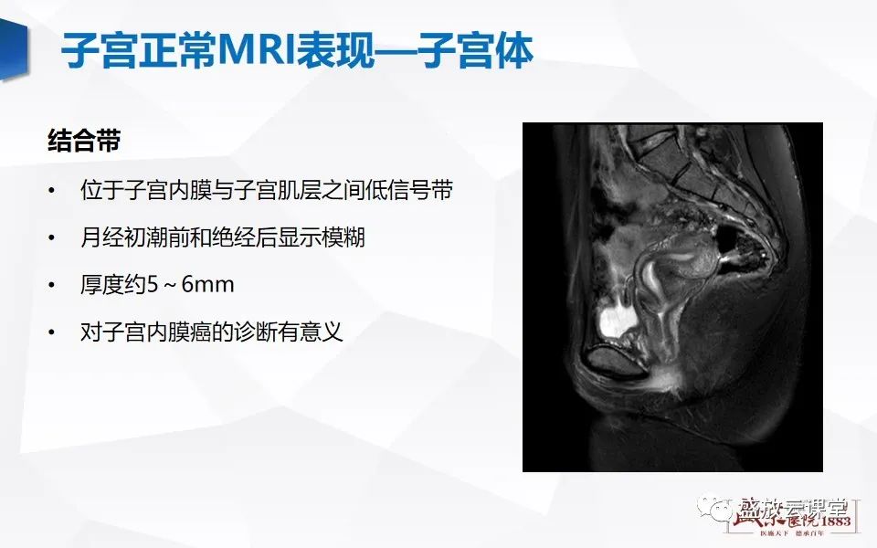 影像PPT - 【PPT】子宫病变MRI诊断-8